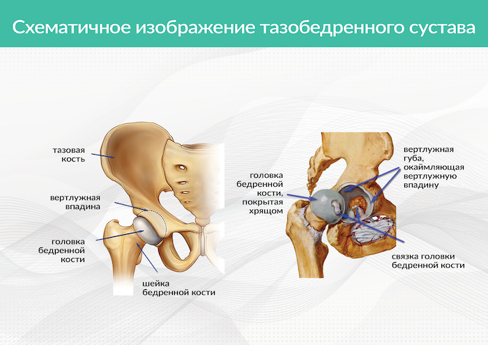 Купить Тазобедренный Сустав В Новосибирске